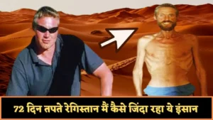 Ricky Megee Survival Story in Hindi